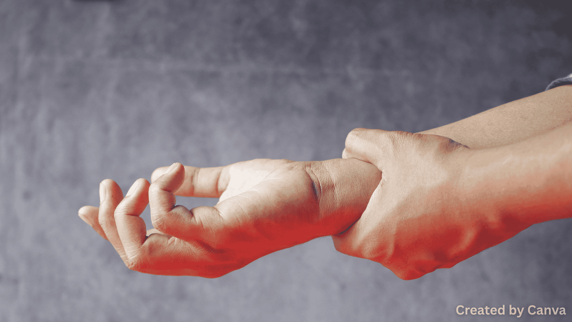 Nerve Damage After a Rear-End Collision: Symptoms & Treatment