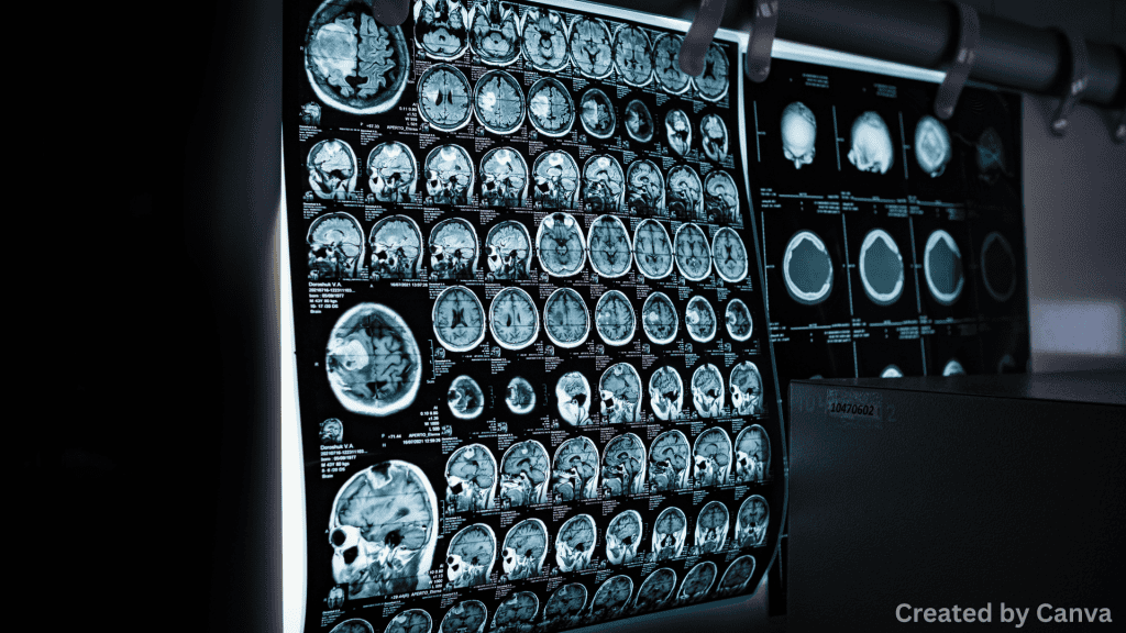 Rear-End Collision MRI: When You Need One (And When You Don’t)