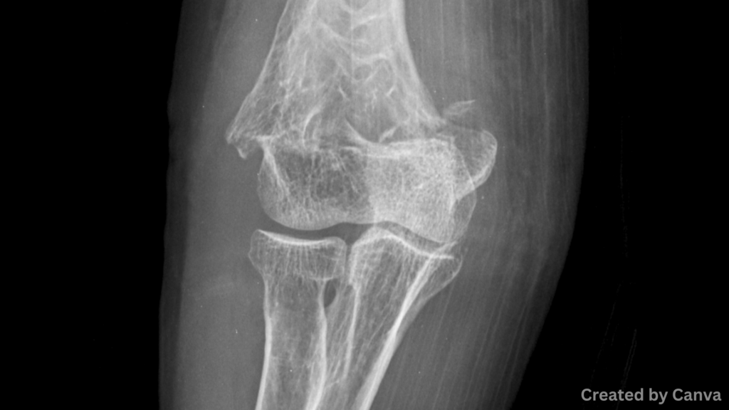 Injuries that aren't obvious can happen later.