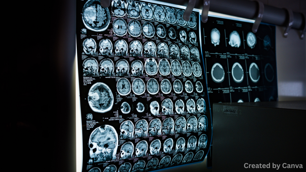 Signs You Need an MRI After a Rear-End Collision
